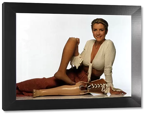 Heather Mills Model who had her leg Amputaterd holding false leg Dbase