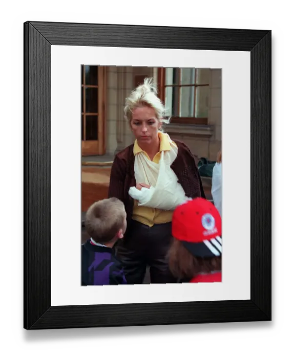 Framed Print : Sheryl Gascoigne with bruised marks made by Gazza wearing bandage sling round arm brown