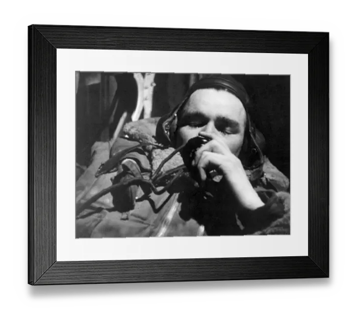 Framed Print : A wounded RAF radio operator during World War Two September 1941