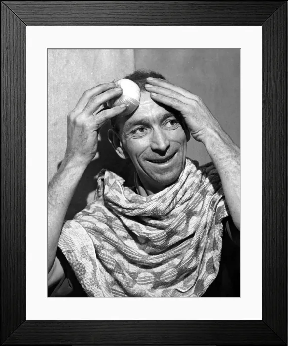 Framed Print : Mr John Harris of Cardiff tries an onion rub on his bald patches to encourage growth of Framed Print : Mr John Harris of Cardiff tries an onion rub on his bald patches to encourage growth of