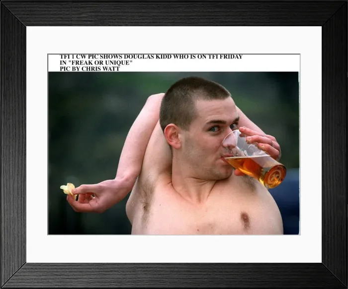 Framed Print : Douglas Kidd drinking glass pint of lager with his arm bent around the back of his head