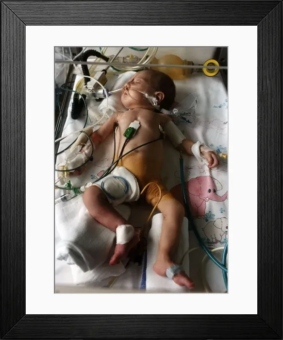 Framed Print : Zenaida Agic sleeping peacefully in the incubator. She was airlifted out of Sarajevo Framed Print : Zenaida Agic sleeping peacefully in the incubator. She was airlifted out of Sarajevo
