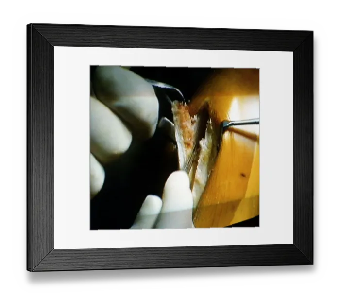 Framed Print : Operation on the knee of England and Lazio footballer Paul Gascoigne Framed Print : Operation on the knee of England and Lazio footballer Paul Gascoigne