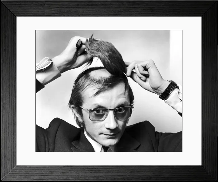 Framed Print : Mr Graham George attaching a hair piece to the shaved bald patch on top of his head Framed Print : Mr Graham George attaching a hair piece to the shaved bald patch on top of his head