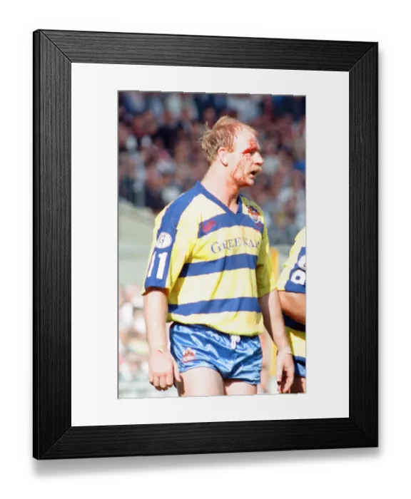 Framed Print : Bloodied Bob Jackson of Warrington is dejected after their defeat by Wigan in the Rugby