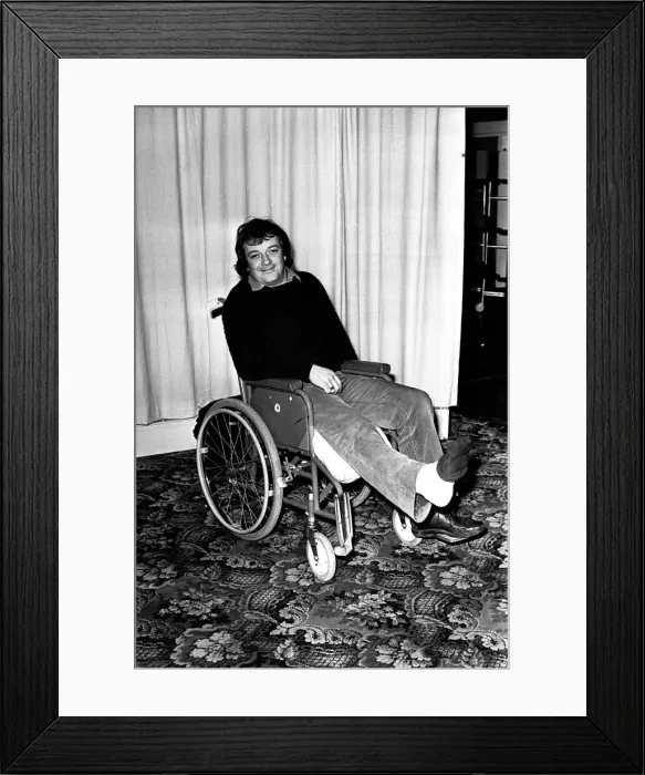 Framed Print : Actor Tim Healy decided the show must go on in spite of an unlucky break