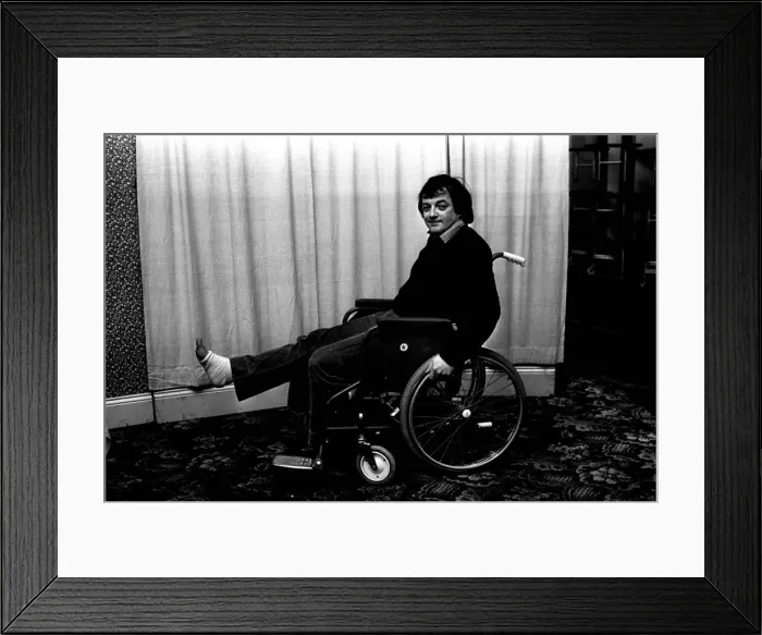 Framed Print : Actor Tim Healy decided the show must go on in spite of an unlucky break