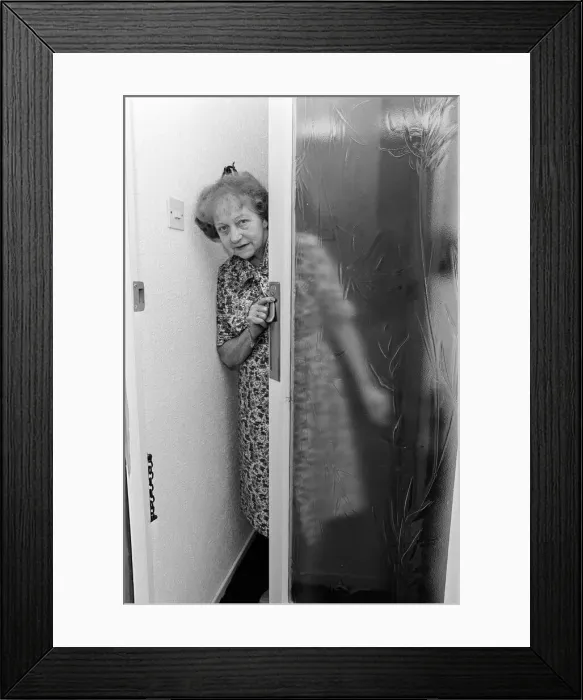Framed Print : Smallpox Outbreak Birmingham 1978. Janet Parker a British medical photographer became Framed Print : Smallpox Outbreak Birmingham 1978. Janet Parker a British medical photographer became