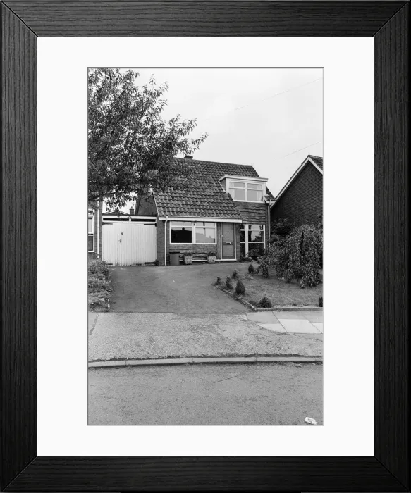 Framed Print : Smallpox Outbreak Birmingham 1978. Janet Parker a British medical photographer became Framed Print : Smallpox Outbreak Birmingham 1978. Janet Parker a British medical photographer became