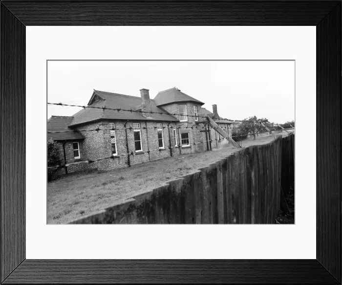 Framed Print : Smallpox Outbreak Birmingham 1978. Janet Parker a British medical photographer became