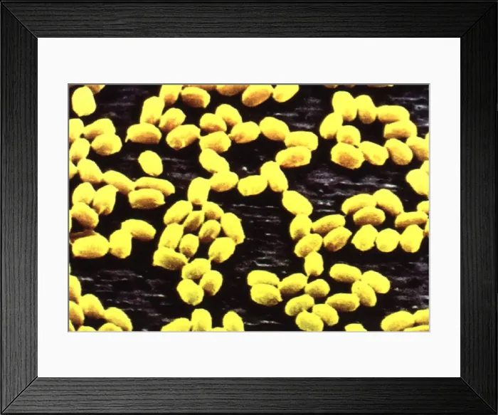Framed Print : ANTHRAX UNDER ELECTRON MICROSCOPE - FEBRUARY 1998 FEATURE BY NATHAN YATES ON DR Framed Print : ANTHRAX UNDER ELECTRON MICROSCOPE - FEBRUARY 1998 FEATURE BY NATHAN YATES ON DR