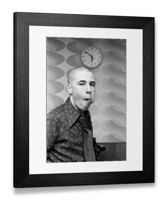 Framed Print : A man with a Kojak'hair cut. 1975