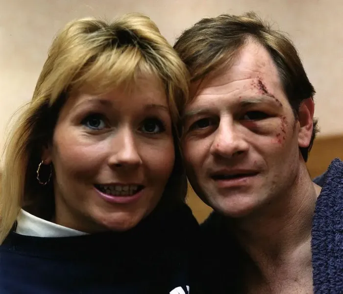 Framed Print : Alex Higgins snooker player alias Hurricane Higgins with new love Siobhan Kidd The scar Framed Print : Alex Higgins snooker player alias Hurricane Higgins with new love Siobhan Kidd The scar