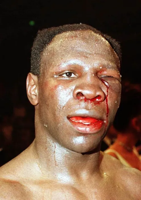 Framed Print : Chris Eubank defeated British boxer April 1998 Chris Eubank after his fight with