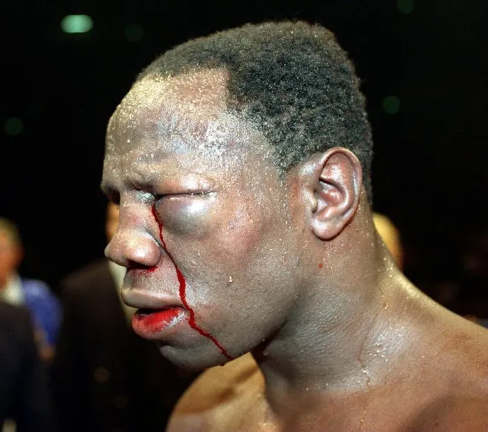 Framed Print : Chris Eubank defeated British boxer April 1998 Chris Eubank after his fight with Framed Print : Chris Eubank defeated British boxer April 1998 Chris Eubank after his fight with