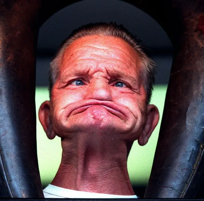 Framed Print : Dennis Russell From Walsall Taking part in the gurning competition in Dudley Framed Print : Dennis Russell From Walsall Taking part in the gurning competition in Dudley