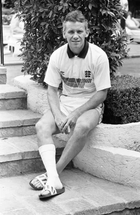 Framed Print : England footballer Peter Reid with bandaged right leg following an injury Framed Print : England footballer Peter Reid with bandaged right leg following an injury
