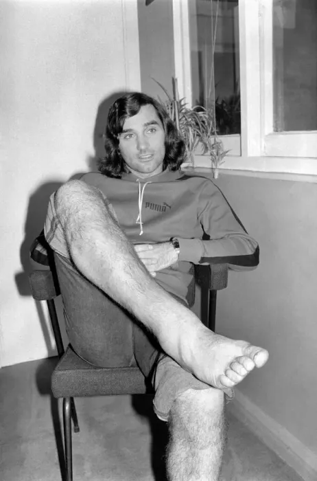 Framed Print : Footballer: George Best. George Best shows his injured legs today