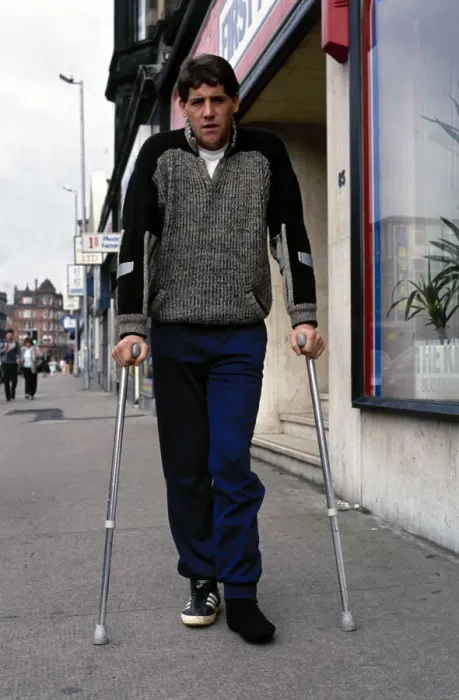 Framed Print : Footballer Ted McMinn in crutches after an injury on the football field September Framed Print : Footballer Ted McMinn in crutches after an injury on the football field September