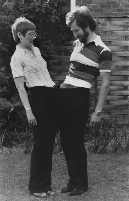 Framed Print : Janet and Tony share a pair of her old size 28 trousers after she lost a large amount of Framed Print : Janet and Tony share a pair of her old size 28 trousers after she lost a large amount of