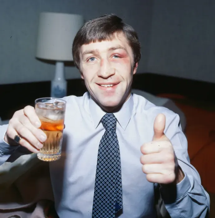 Framed Print : Ken Buchanan boxer December 1979 Holding glass thumbs up black eye