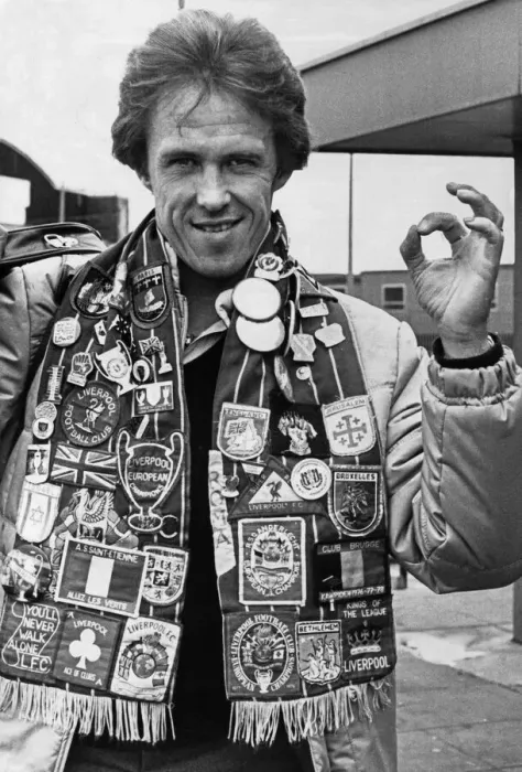 Framed Print : Liverpool footballer Phil Neal wearing a club scarf decorated with badges celebrating Framed Print : Liverpool footballer Phil Neal wearing a club scarf decorated with badges celebrating