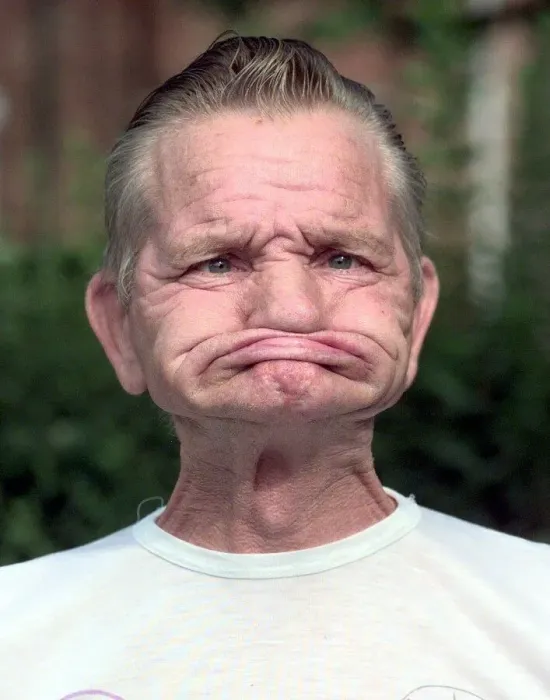 Framed Print : Mr Dennis Russell of Walsall with another of his gurning th June 1998