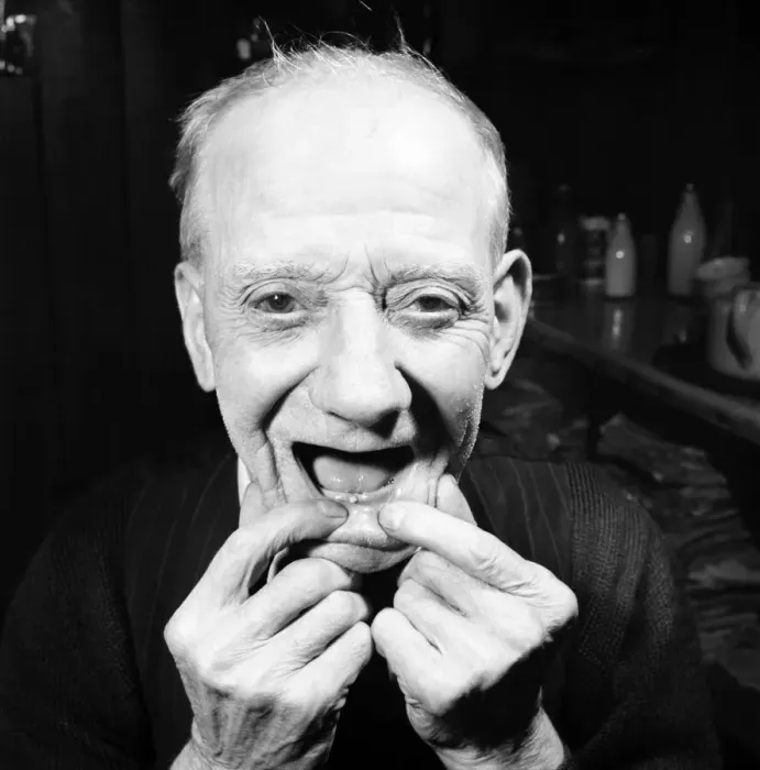 Framed Print : Pensioner with a new tooth. 77 year old man (George Berry) shows off his new tooth
