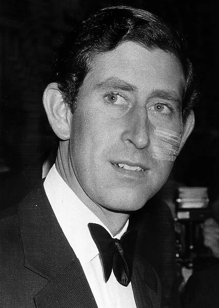 Prince Charles with six stitches on face, covered with plasters May 1980