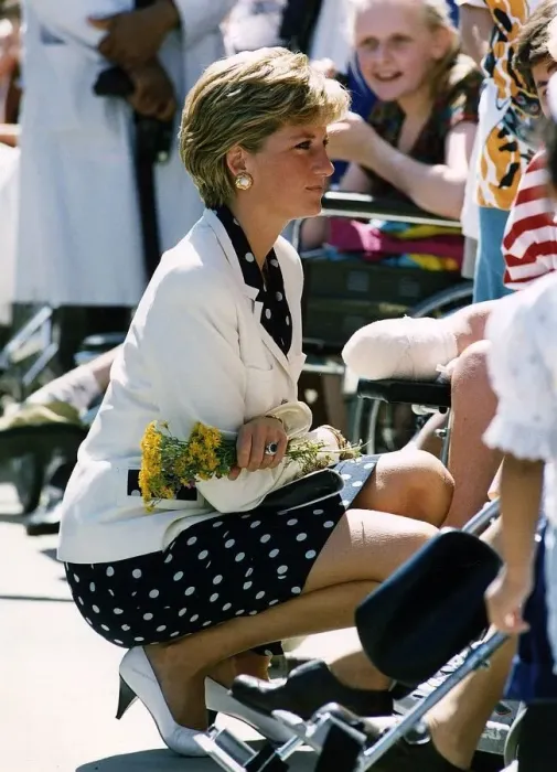 Framed Print : Princess Diana at the Royal National Orthopaedic Hospital in Stanmore, North London