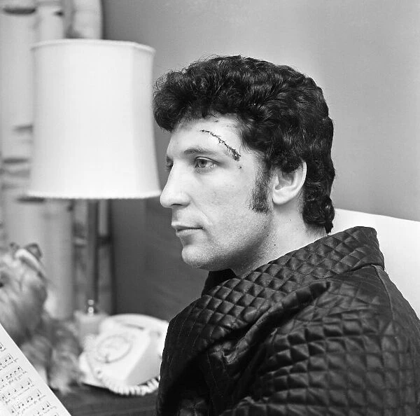 Singer Tom Jones at home with stitched head wound caused by a recent car crash
