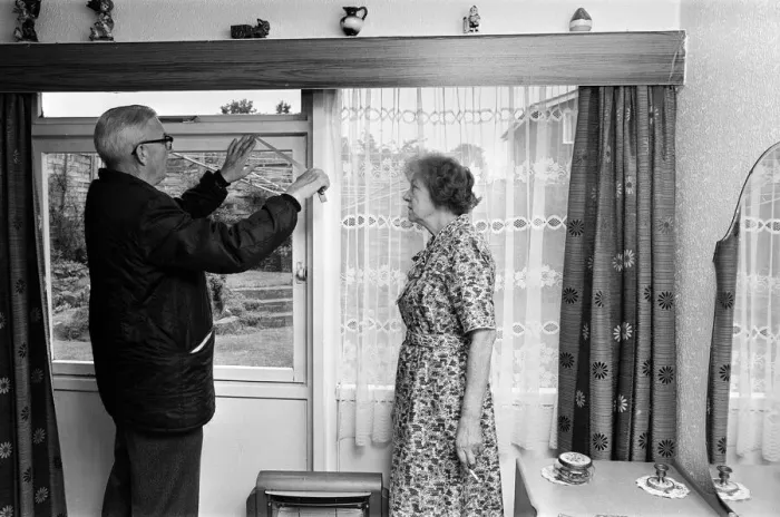 Framed Print : Smallpox Outbreak Birmingham 1978. Janet Parker a British medical photographer became Framed Print : Smallpox Outbreak Birmingham 1978. Janet Parker a British medical photographer became