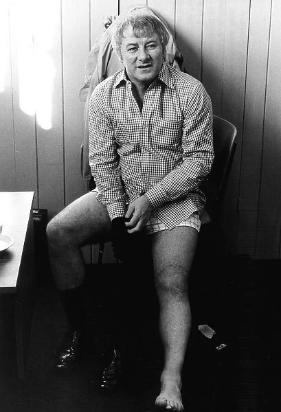 Tommy Docherty 1980 Leg injured after attack by yobs on a train