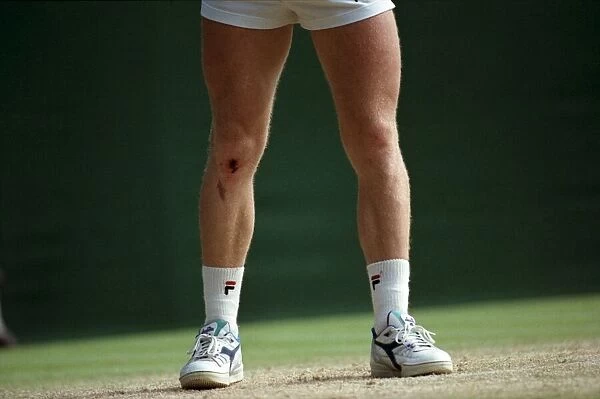 Wimbledon Tennis. Picture showing injury to Boris Becker. July 1991 91-4261-199
