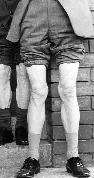 The winner of a knobbly knees competition