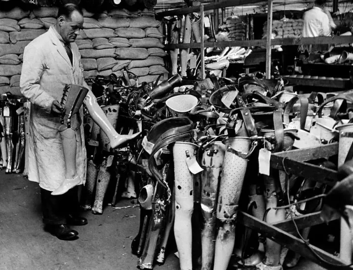 Framed Print : WW2 William Houston making artifical legs 1942 at Roehampton Hospital London Framed Print : WW2 William Houston making artifical legs 1942 at Roehampton Hospital London