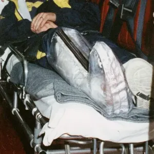 Ally McCoist Print - Broken Leg Arrival 1994