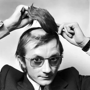 Mr Graham George attaching a hair piece to the shaved bald patch on top of his head