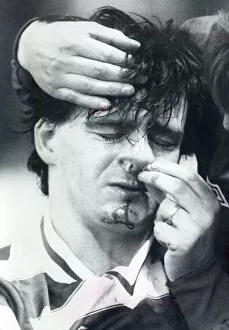 Images Dated 1st January 1982: Charlie Nicholas Celtic player injured 1982 celtic player charlie nicholas with a