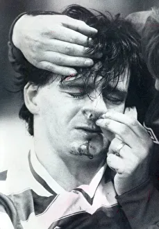 01468 Prints: Charlie Nicholas Celtic player injured 1982 celtic player charlie nicholas with a