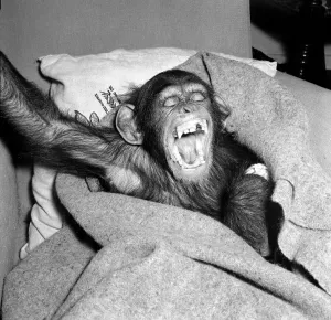 Dentist Prints: Johnny the Chimpanzee seen here recovering after having his tooth pulled by the dentist