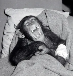 Dentist Prints: Johnny the Chimpanzee seen here recovering after having his tooth pulled by the dentist