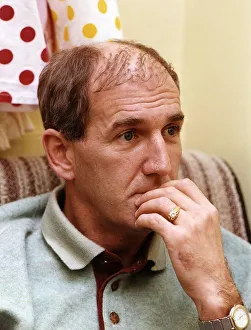 Russ Abbot in a theatre dressing room shows his Hair Transplant A&copy;Mirrorpix