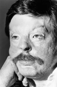 Plastic Surgery Prints: Soldier Simon Weston, scarred during an Argentine attack on Sir Galahad troopship in
