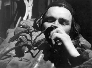 00206 Prints: A wounded RAF radio operator during World War Two September 1941